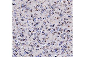 IHC analysis of MPPB/PMPCB using anti-MPPB/PMPCB antibody (ABIN7600758). (PMPCB anticorps  (AA 23-479))