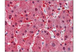 Immunohistochemistry Image: Human Liver: Formalin-Fixed, Paraffin-Embedded (FFPE) (ASS1 anticorps  (Internal Region))