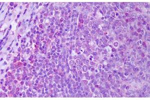 Anti-RANKL antibody IHC staining of human tonsil, germinal center. (RANKL anticorps)