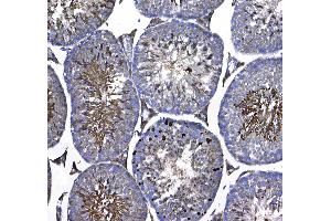 IHC analysis of GSTM3 using anti-GSTM3 antibody .