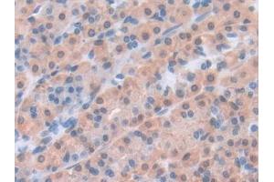 Detection of LEP in Rat Stomach Tissue using Polyclonal Antibody to Leptin (LEP)