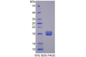 SDS-PAGE analysis of Human PPAP2B Protein. (PPAP2B Protéine)