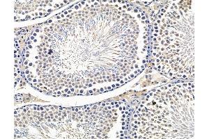 ABIN7096436 and ABIN7100500 at 1/100 staining rat testis tissue by IHC-P.