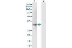 Western Blot analysis of UCP2 expression in transfected 293T cell line by UCP2 MaxPab polyclonal antibody. (UCP2 anticorps  (AA 1-309))