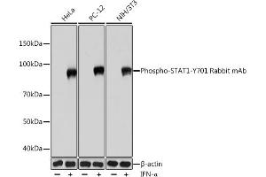 Western blot analysis of extracts of various cell lines, using Phospho-ST-Y701 Rabbit mAb (ABIN7270301) at 1:1000 dilution.