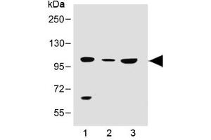 Western blot testing of human 1) 293T/17, 2) brain and 3) K562 lysate with SLC14A2 antibody at 1:500.
