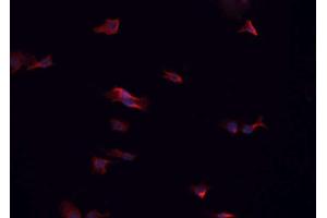ABIN6266575 staining HeLa cells by IF/ICC. (Cytokeratin 7 anticorps  (C-Term))