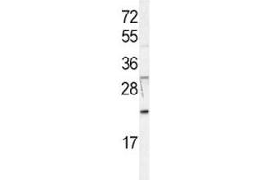 Western blot analysis of HRAS antibody in Jurkat lysate. (HRAS anticorps  (AA 104-128))