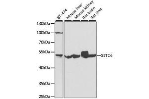 Western blot analysis of extracts of various cell lines, using SETD6 antibody. (SETD6 anticorps  (AA 301-473))