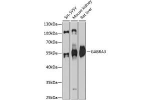 Western blot analysis of extracts of various cell lines, using G antibody (ABIN6131687, ABIN6140903, ABIN6140906 and ABIN6215329) at 1:3000 dilution. (GABRA3 anticorps  (AA 29-276))