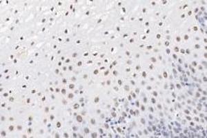 Immunohistochemistry analysis of paraffin-embedded human esophagus using,Ring1A (ABIN7075467) at dilution of 1: 3600