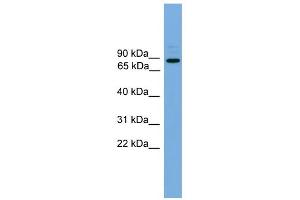 WB Suggested Anti-ARHGEF19 Antibody Titration: 0. (ARHGEF19 anticorps  (Middle Region))