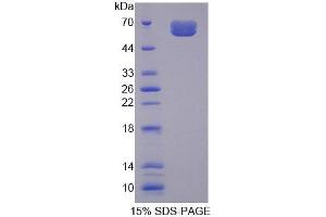 SDS-PAGE (SDS) image for Myosin Binding Protein C, Cardiac (MYBPC3) (AA 1-328) protein (His tag) (ABIN6236951)