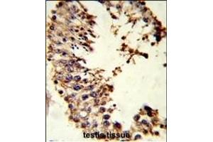 Formalin-fixed and paraffin-embedded human testis tissue reacted with ACR Antibody (Center), which was peroxidase-conjugated to the secondary antibody, followed by DAB staining. (Acrosin anticorps  (AA 99-127))