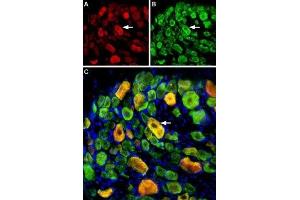 Multiplex staining of ASIC1 and ASIC3 in rat DRG - Immunohistochemical staining of perfusion-fixed frozen rat dorsal root ganglia (DRG) sections using Guinea pig Anti-ASIC1 Antibody (ABIN7042914, ABIN7045410 and ABIN7045411), (1:400) and rabbit Anti-ASIC3 Antibody (ABIN7042917, ABIN7045243 and ABIN7045244), (1:400).