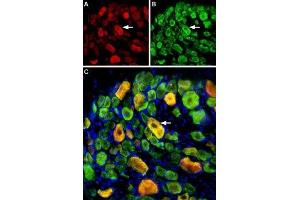 Multiplex staining of ASIC1 and ASIC3 in rat DRG - Immunohistochemical staining of perfusion-fixed frozen rat dorsal root ganglia (DRG) sections using Guinea pig Anti-ASIC1 Antibody (ABIN7042914, ABIN7045410 and ABIN7045411), (1:400) and rabbit Anti-ASIC3 Antibody (ABIN7042917, ABIN7045243 and ABIN7045244), (1:400). (ASIC3 anticorps  (Intracellular, N-Term))