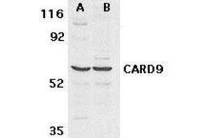 Western blot analysis of CARD9 expression in human MDA- MB-361 (A) and PC-3 (B) cell lysate withCARD9 antibody at 2.