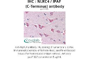 Image no. 1 for anti-NLR Family, CARD Domain Containing 4 (NLRC4) antibody (ABIN1737383) (NLRC4 anticorps)