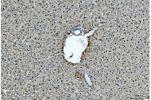 IHC analysis of ADH1A using anti-ADH1A antibody (ABIN4886427). (ADH1A anticorps  (AA 213-375))