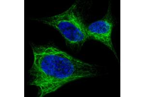 Fluorescent confocal image of SH-SY5Y cells stained with Nestin  antibody. (Nestin anticorps  (AA 1389-1416))