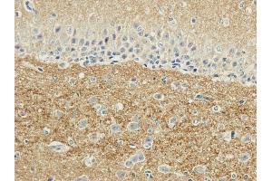Immunohistochemical staining of rabbit brain using anti-SNAP25 antibody ABIN7072250 Formalin fixed rabbit brain slices were were stained with a ABIN7072250 at 3 μg/mL.