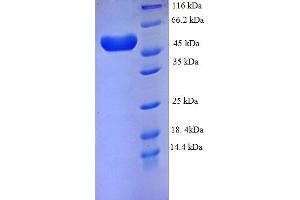 SDS-PAGE (SDS) image for Plexin A4 (PLXNA4) (AA 24-522), (partial) protein (His tag) (ABIN5711767)