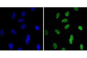 Immunocytochemistry (ICC) image for anti-Chromobox Homolog 1 (CBX1) antibody (ABIN1845962) (CBX1 anticorps)