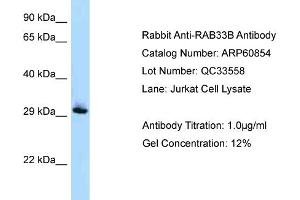 Western Blotting (WB) image for anti-RAB33B, Member RAS Oncogene Family (RAB33B) (Middle Region) antibody (ABIN2788609) (RAB33B anticorps  (Middle Region))