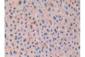 Detection of Pgp in Human Liver Tissue using Polyclonal Antibody to Permeability Glycoprotein (Pgp)