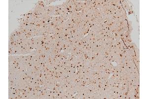 ABIN6267443 at 1/100 staining rat brain tissue sections by IHC-P.