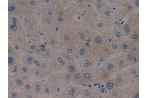 Detection of TLR9 in Human Liver Tissue using Polyclonal Antibody to Toll Like Receptor 9 (TLR9)