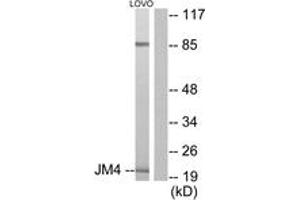 Western blot analysis of extracts from LOVO cells, using JM4 Antibody. (PRAF2 anticorps  (AA 129-178))