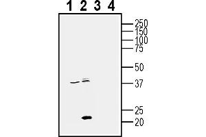 Western blot analysis of human PC3 prostate adenocarcinoma cell line lysates (lanes 1 and 3) and human MDA- breast adenocarcinoma cell line lysate (lanes 2 and 4):1-2. (CD81 anticorps  (Extracellular))