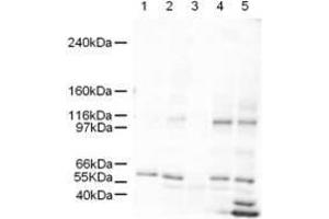 SMARCAL1 anticorps  (AA 80-96)