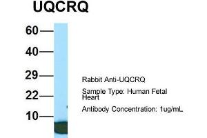 Host: Rabbit  Target Name: UQCRQ  Sample Tissue: Human Fetal Heart  Antibody Dilution: 1. (UQCRQ anticorps  (Middle Region))