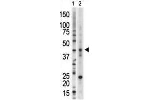 Western Blotting (WB) image for anti-Vaccinia Related Kinase 1 (VRK1) antibody (ABIN3003194)