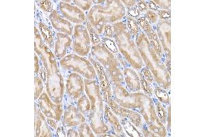 Immunohistochemistry of paraffin-embedded mouse kidney using USO1 Rabbit mAb (ABIN7271234) at dilution of 1:25 (40x lens). (USO1 anticorps)