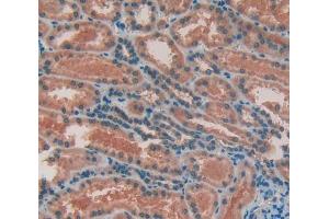 IHC-P analysis of kidney tissue, with DAB staining. (Glucocorticoid Receptor anticorps  (AA 41-184))