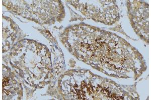 ABIN6269276 at 1/100 staining Mouse testis tissue by IHC-P. (VASP anticorps  (Internal Region))