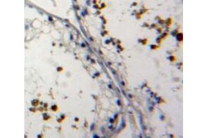 Used in DAB staining on fromalin fixed paraffin-embedded testis tissue (NUP62 anticorps  (AA 186-432))