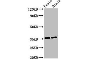 Western Blot Positive WB detected in: Mouse brain tissue, Rat brain tissue All lanes: NIT1 antibody at 3 μg/mL Secondary Goat polyclonal to rabbit IgG at 1/50000 dilution Predicted band size: 36, 32, 41, 35, 27 kDa Observed band size: 36 kDa (Nitrilase 1 anticorps  (AA 1-243))