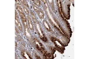 Immunohistochemical staining of human stomach with SLC41A2 polyclonal antibody  shows strong cytoplasmic positivity in glandular cells at 1:50-1:200 dilution. (SLC41A2 anticorps)