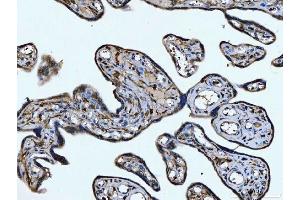 IHC analysis of CD14 using anti-CD14 antibody (ABIN7600531).
