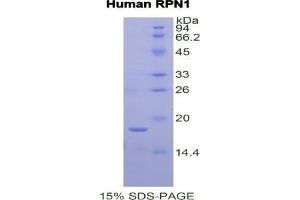 SDS-PAGE analysis of Human Ribophorin I Protein. (RPN1 Protéine)