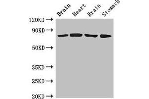 Western Blot Positive WB detected in: Rat brain tissue, Rat heart tissue, Mouse brain tissue, Mouse stomach tissue All lanes: SLCO1B1 antibody at 4 μg/mL Secondary Goat polyclonal to rabbit IgG at 1/50000 dilution Predicted band size: 77 kDa Observed band size: 77 kDa (SLCO1B1 anticorps  (AA 426-537))