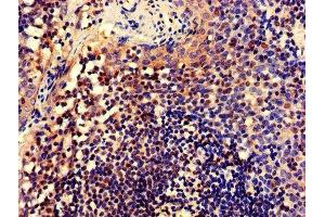 IHC image of ABIN7148735 diluted at 1:600 and staining in paraffin-embedded human tonsil tissue performed on a Leica BondTM system.