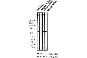 Western blot analysis of Phospho-Chk2 (Thr68) expression in various lysates (CHEK2 anticorps  (pThr68))
