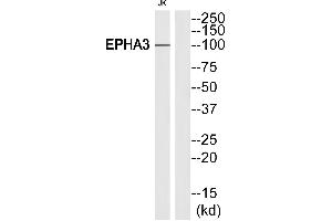 Western blot analysis of extracts from Jurkat cells, using EPHA3 (Ab-602)antibody. (EPH Receptor A3 anticorps  (Internal Region))
