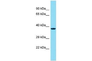 Host: Rabbit Target Name: C14orf79 Sample Type: HepG2 Whole Cell lysates Antibody Dilution: 1. (C14ORF79 anticorps  (N-Term))