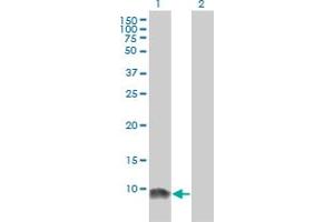 Western Blot analysis of LSM6 expression in transfected 293T cell line by LSM6 monoclonal antibody (M01), clone 4B5-1B10.